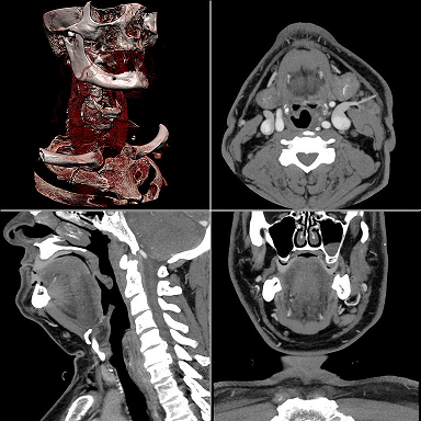 http://commons.wikimedia.org/wiki/File:Ct-workstation-neck.jpg